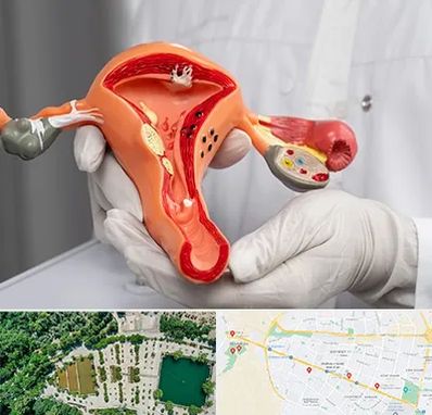 دکتر سرطان رحم در وکیل آباد مشهد 