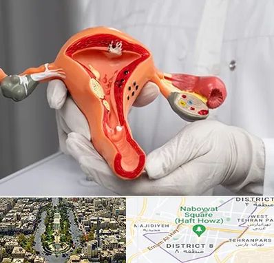 دکتر سرطان رحم در نارمک 