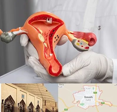 دکتر سرطان رحم در ساوه