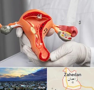 دکتر سرطان رحم در زاهدان