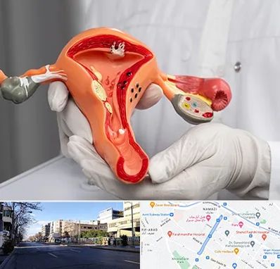 دکتر سرطان رحم در خیابان ملاصدرا شیراز 