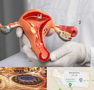 دکتر سرطان رحم در بهارستان