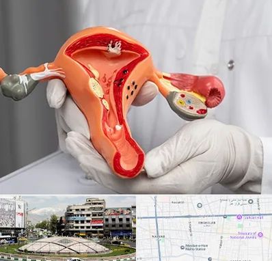 دکتر سرطان رحم در مرکز تهران