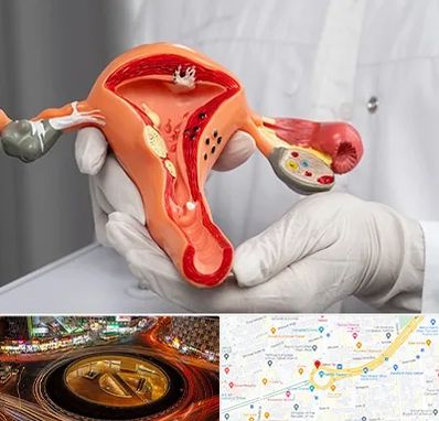 دکتر سرطان رحم در میدان ولیعصر 