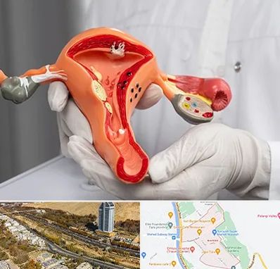 دکتر سرطان رحم در خیابان نیایش شیراز 