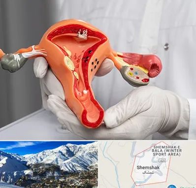 دکتر سرطان رحم در شمشک