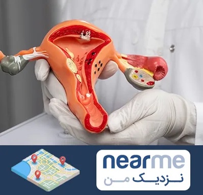 دکتر سرطان رحم در نزدیک من