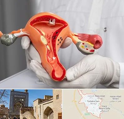 دکتر سرطان رحم در تربت جام