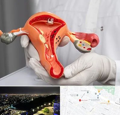 دکتر سرطان رحم در هفت تیر مشهد 