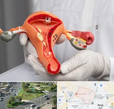 دکتر سرطان رحم در شاهین ویلا کرج 