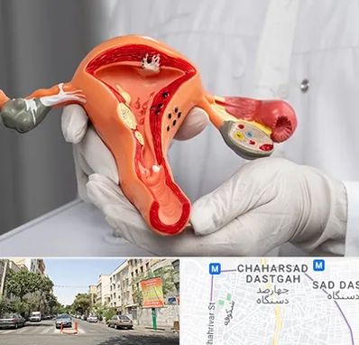 دکتر سرطان رحم در چهارصد دستگاه 