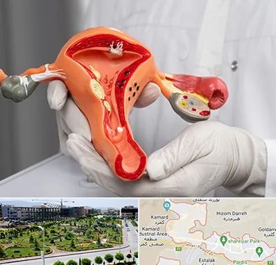 دکتر سرطان رحم در پردیس
