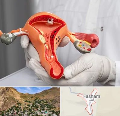 دکتر سرطان رحم در فشم