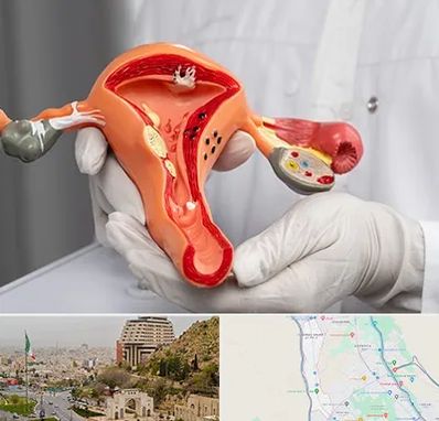 دکتر سرطان رحم در فرهنگ شهر شیراز 