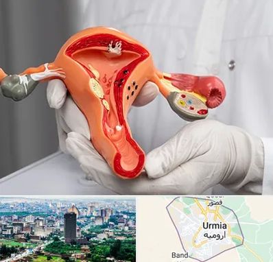 دکتر سرطان رحم در ارومیه