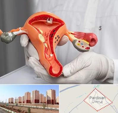 دکتر سرطان رحم در پردیسان قم