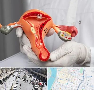 دکتر سرطان رحم در نادری اهواز 