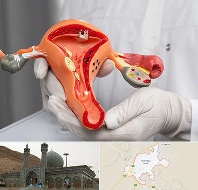 دکتر سرطان رحم در شهرضا