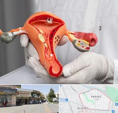 دکتر سرطان رحم در پرواز تبریز