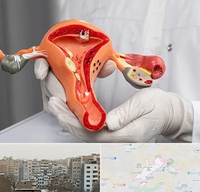 دکتر سرطان رحم در محمد شهر کرج 