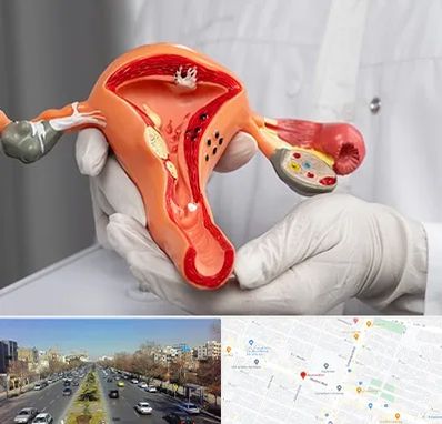 دکتر سرطان رحم در بلوار معلم مشهد 