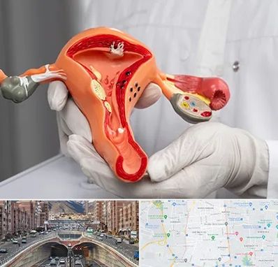 دکتر سرطان رحم در منطقه 10 تهران 