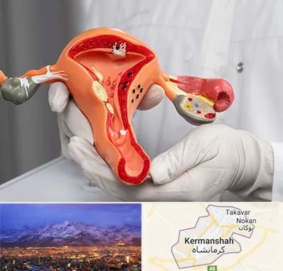 دکتر سرطان رحم در کرمانشاه
