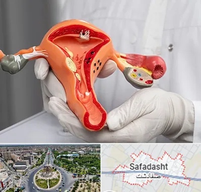 دکتر سرطان رحم در صفادشت