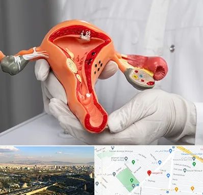 دکتر سرطان رحم در هنگام 