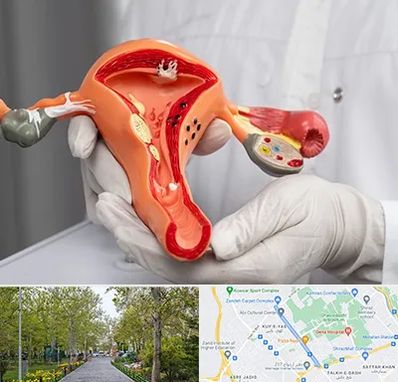 دکتر سرطان رحم در قدوسی غربی شیراز 