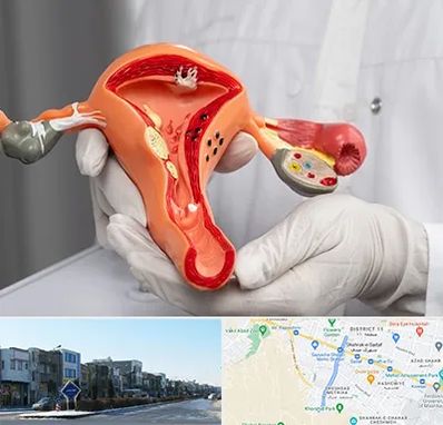 دکتر سرطان رحم در شریعتی مشهد 