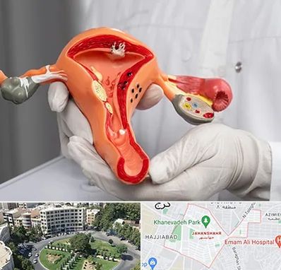 دکتر سرطان رحم در جهانشهر کرج 