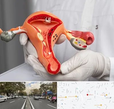 دکتر سرطان رحم در دولت 