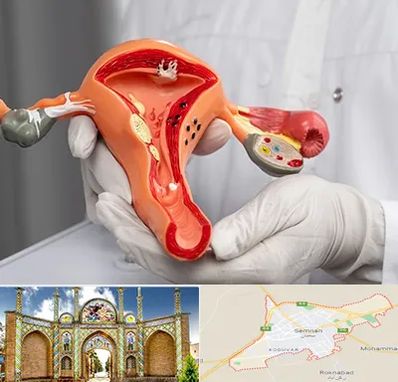 دکتر سرطان رحم در سمنان
