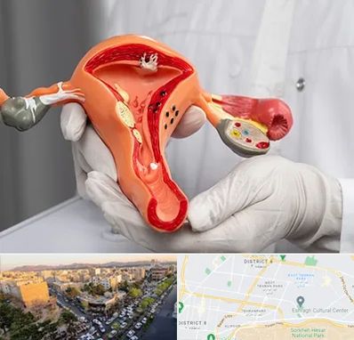 دکتر سرطان رحم در تهرانپارس 