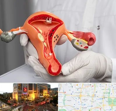 دکتر سرطان رحم در جنت آباد تهران 