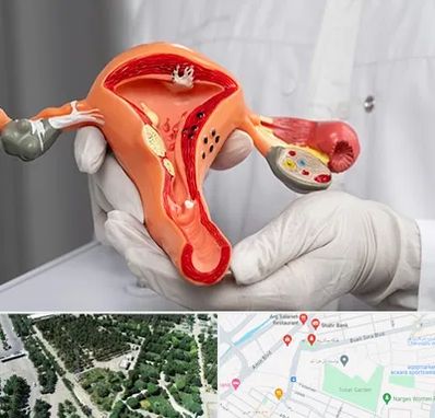 دکتر سرطان رحم در سالاریه قم