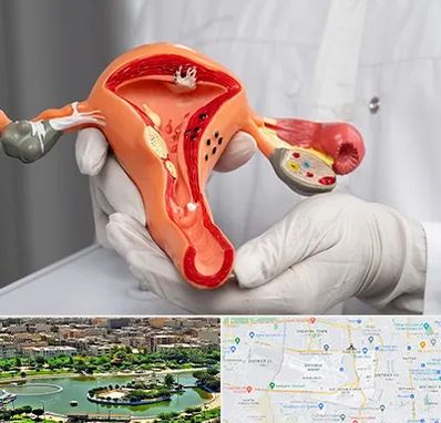 دکتر سرطان رحم در منطقه 9 تهران 