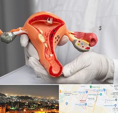 دکتر سرطان رحم در مارلیک کرج 