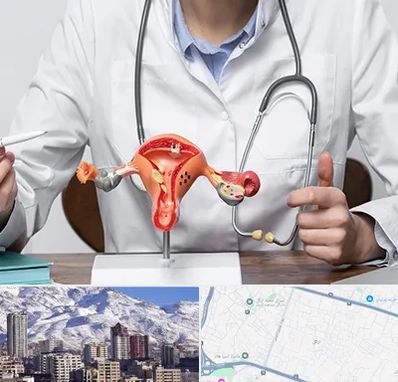 جراح سرطان رحم در ازگل