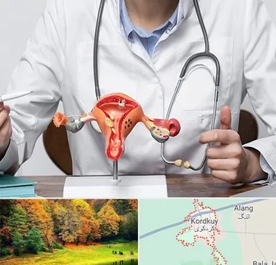 جراح سرطان رحم در کردکوی