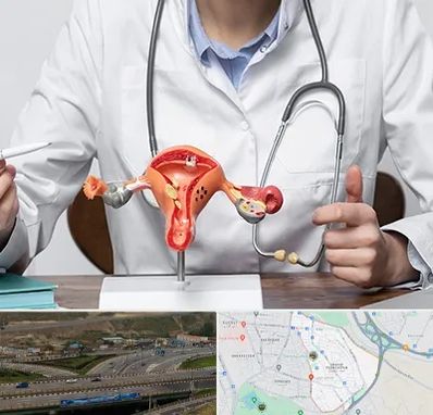 جراح سرطان رحم در یاغچیان تبریز