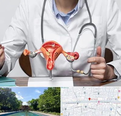 جراح سرطان رحم در هشت بهشت اصفهان 