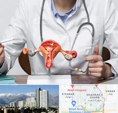 جراح سرطان رحم در شهرک غرب 