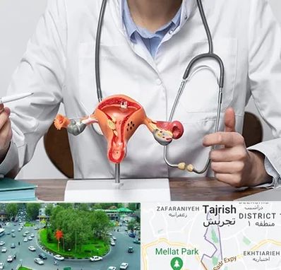 جراح سرطان رحم در تجریش 