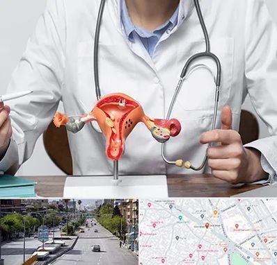 جراح سرطان رحم در خیابان زند شیراز 