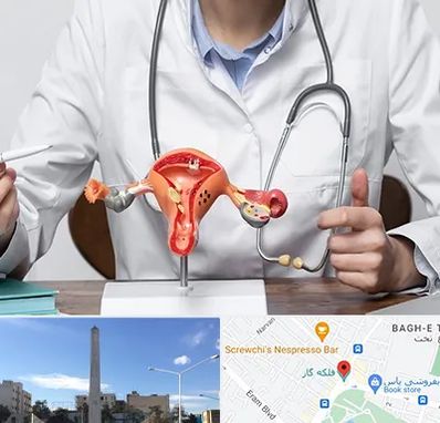 جراح سرطان رحم در فلکه گاز شیراز 