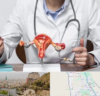 جراح سرطان رحم در فرهنگ شهر شیراز 