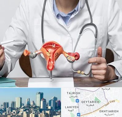 جراح سرطان رحم در قیطریه 
