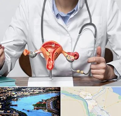 جراح سرطان رحم در خرمشهر